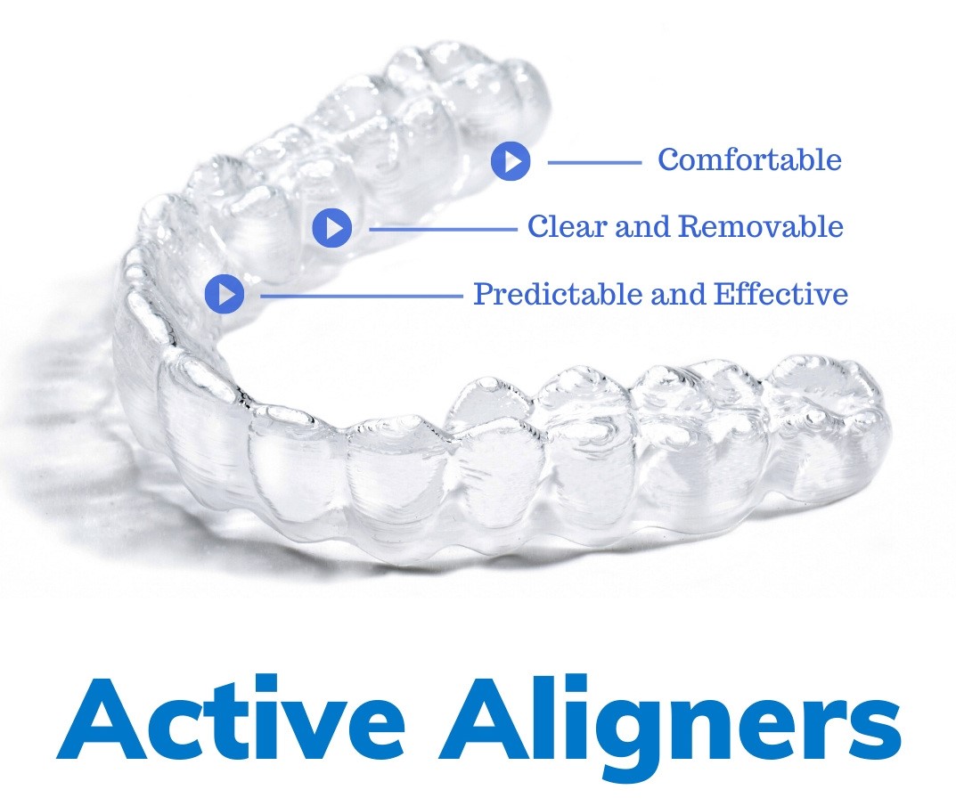 Active Aligners Online Course