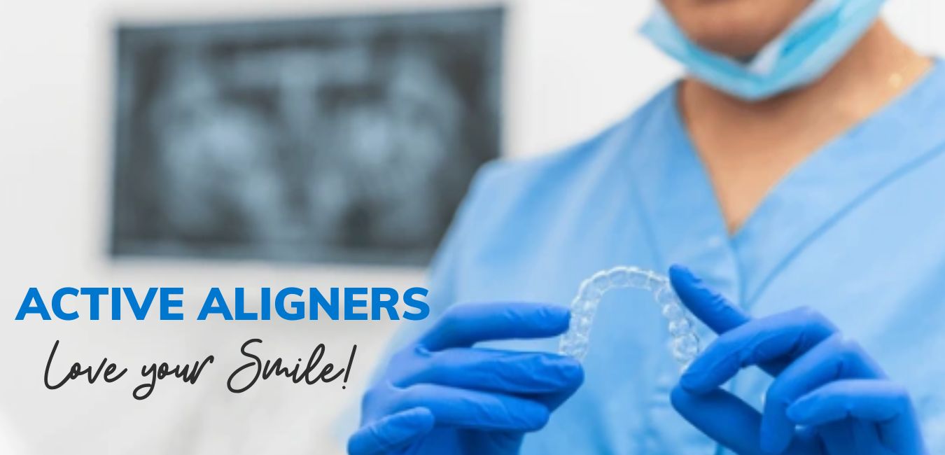 Active Aligners - love your smile!
