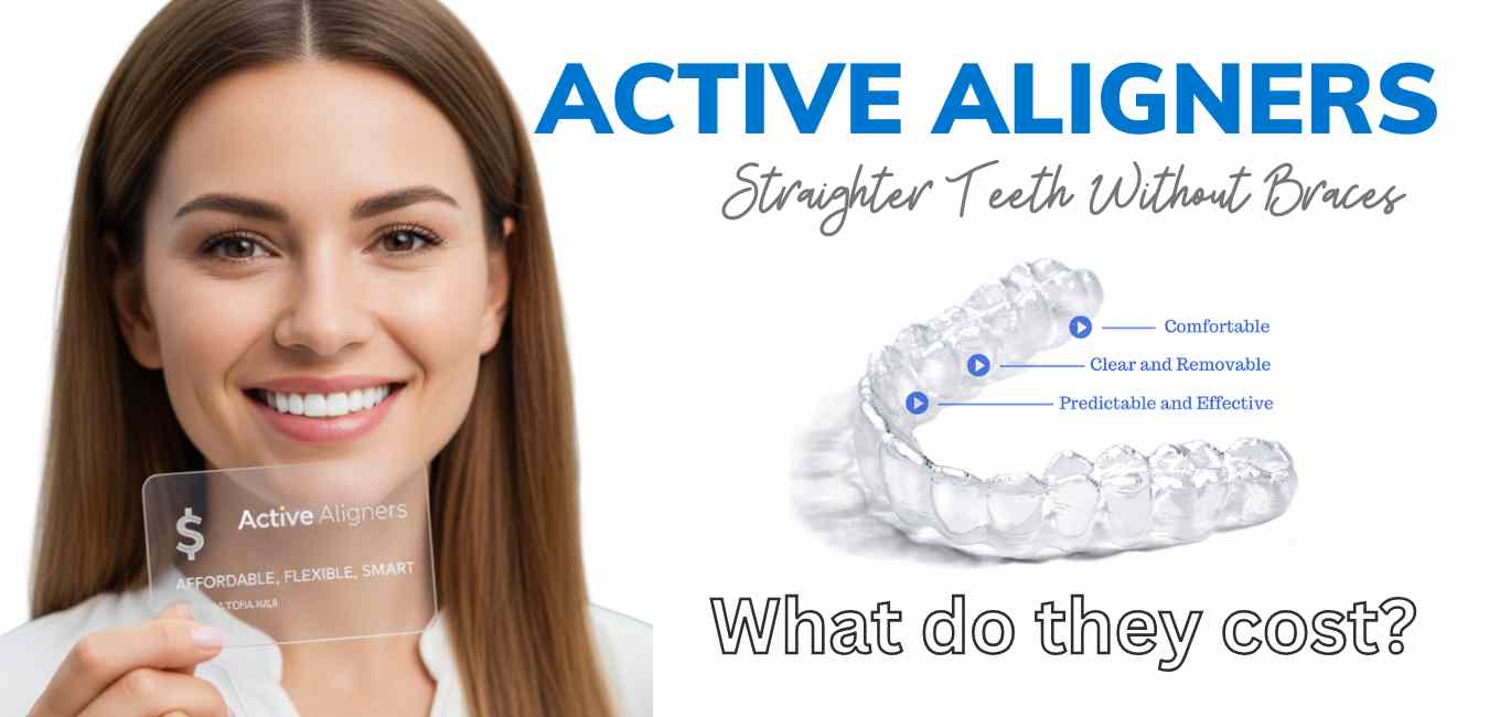 What do Active Aligners cost?