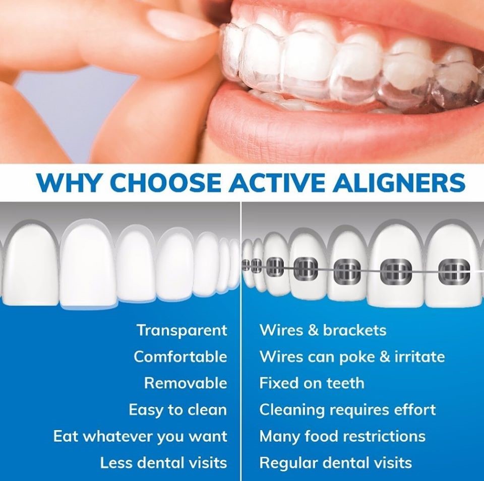 Braces vs Clear Aligners
