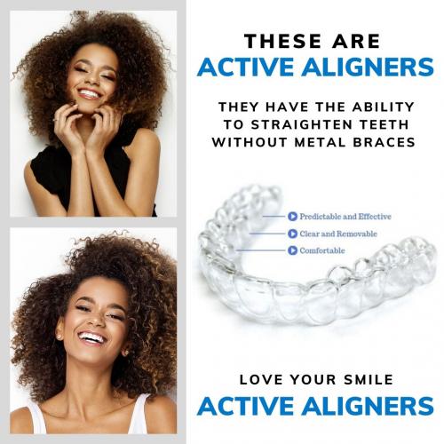 These are as Active Aligners - girl smiling