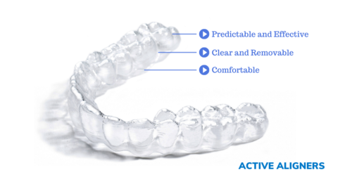 Active-Aligners-image