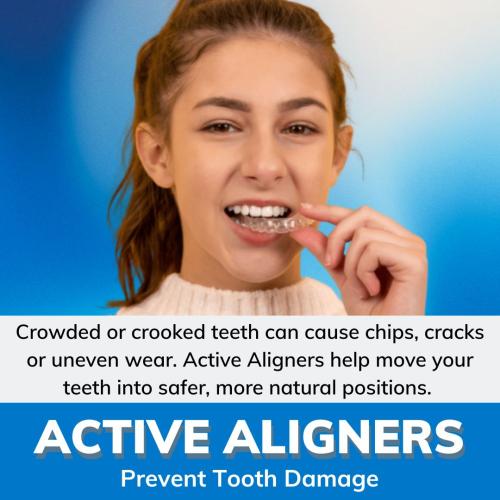 Benefits-Prevent-tooth-damage-Ig