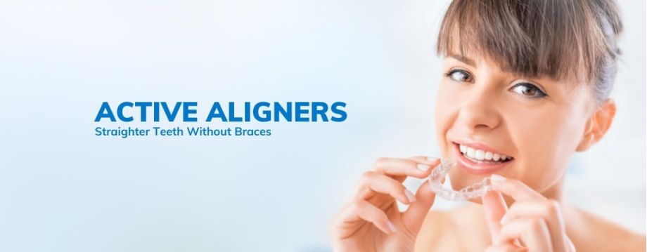 Active Aligners Straighten teeth with braces